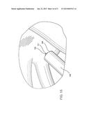 INTRODUCTORY ASSEMBLY AND METHOD FOR INSERTING INTRACARDIAC INSTRUMENTS diagram and image