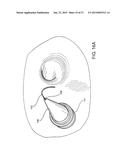 INTRODUCTORY ASSEMBLY AND METHOD FOR INSERTING INTRACARDIAC INSTRUMENTS diagram and image