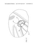 INTRODUCTORY ASSEMBLY AND METHOD FOR INSERTING INTRACARDIAC INSTRUMENTS diagram and image