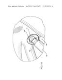 INTRODUCTORY ASSEMBLY AND METHOD FOR INSERTING INTRACARDIAC INSTRUMENTS diagram and image