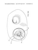 INTRODUCTORY ASSEMBLY AND METHOD FOR INSERTING INTRACARDIAC INSTRUMENTS diagram and image