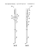 INTRALUMINAL DEVICE DELIVERY TECHNIQUE diagram and image