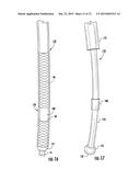 INTRALUMINAL DEVICE DELIVERY TECHNIQUE diagram and image