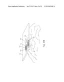 SYSTEMS, METHODS AND DEVICES FOR A SKULL/BRAIN INTERFACE diagram and image