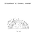 SYSTEMS, METHODS AND DEVICES FOR A SKULL/BRAIN INTERFACE diagram and image