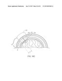 SYSTEMS, METHODS AND DEVICES FOR A SKULL/BRAIN INTERFACE diagram and image