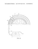 SYSTEMS, METHODS AND DEVICES FOR A SKULL/BRAIN INTERFACE diagram and image