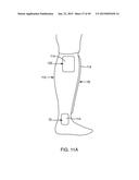 SYSTEMS AND METHODS FOR PROVIDING AN ORTHOPEDIC FOOT SUPPORT diagram and image