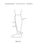 SYSTEMS AND METHODS FOR PROVIDING AN ORTHOPEDIC FOOT SUPPORT diagram and image