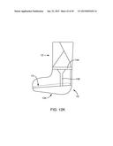 SYSTEMS AND METHODS FOR PROVIDING AN ORTHOPEDIC FOOT SUPPORT diagram and image