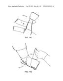 SYSTEMS AND METHODS FOR PROVIDING AN ORTHOPEDIC FOOT SUPPORT diagram and image