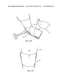 SYSTEMS AND METHODS FOR PROVIDING AN ORTHOPEDIC FOOT SUPPORT diagram and image