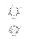 SYSTEMS AND METHODS FOR APPLYING A TOTAL CONTACT AND OFFLOADING CAST diagram and image