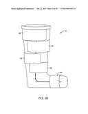 SYSTEMS AND METHODS FOR APPLYING A TOTAL CONTACT AND OFFLOADING CAST diagram and image