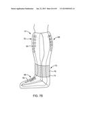 SYSTEMS AND METHODS FOR APPLYING A TOTAL CONTACT AND OFFLOADING CAST diagram and image