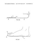 SYSTEMS AND METHODS FOR APPLYING A TOTAL CONTACT AND OFFLOADING CAST diagram and image