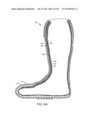 SYSTEMS AND METHODS FOR APPLYING A TOTAL CONTACT AND OFFLOADING CAST diagram and image