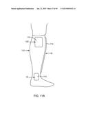 SYSTEMS AND METHODS FOR APPLYING A TOTAL CONTACT AND OFFLOADING CAST diagram and image