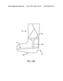 SYSTEMS AND METHODS FOR APPLYING A TOTAL CONTACT AND OFFLOADING CAST diagram and image