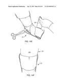 SYSTEMS AND METHODS FOR APPLYING A TOTAL CONTACT AND OFFLOADING CAST diagram and image