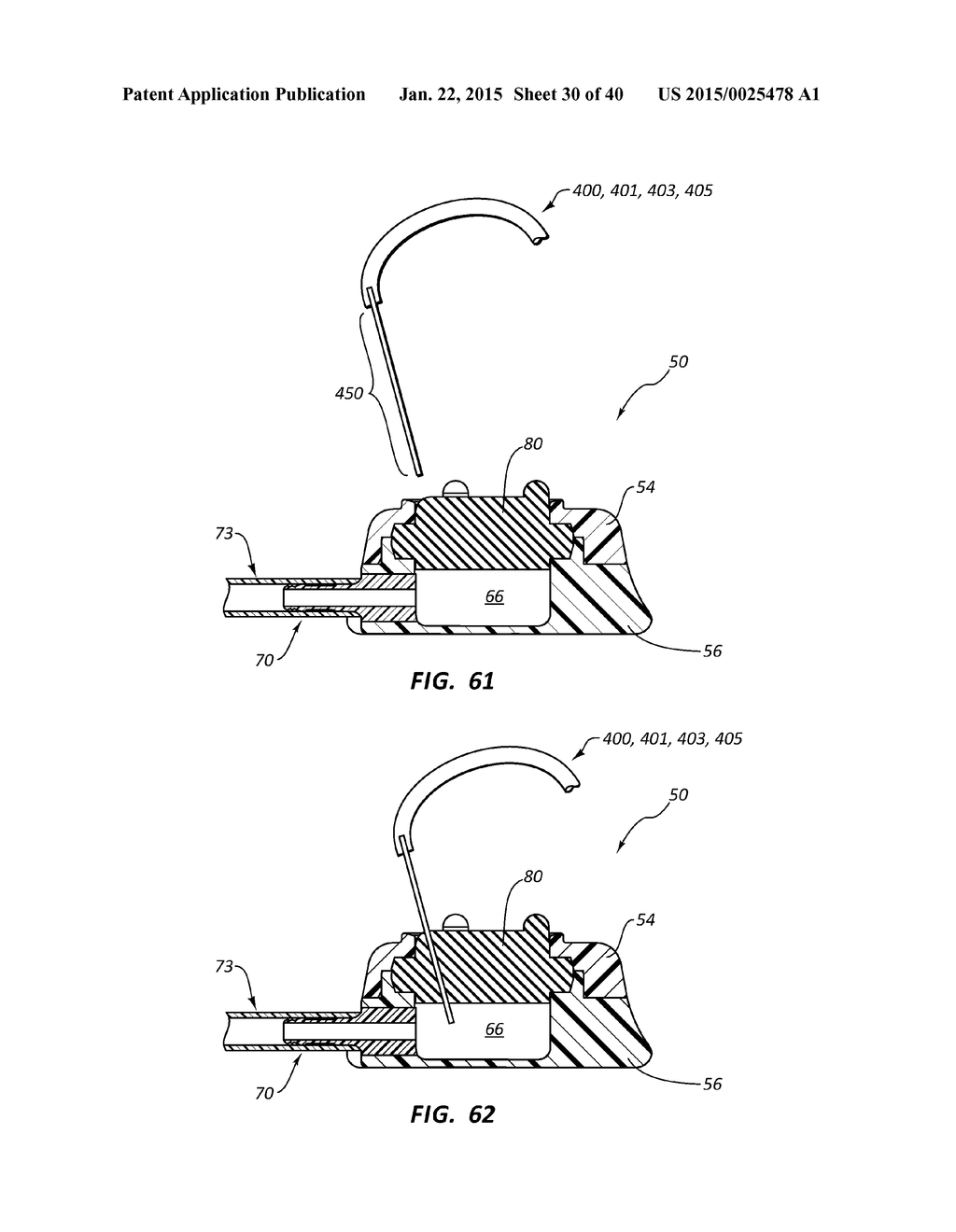 Reinforced Septum for an Implantable Medical Device - diagram, schematic, and image 31