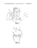 DEVICE AND METHOD FOR INSTALLING FEMORAL PROSTHETIC KNEE JOINT diagram and image