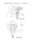 DEVICE AND METHOD FOR INSTALLING FEMORAL PROSTHETIC KNEE JOINT diagram and image