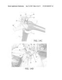 DEVICE AND METHOD FOR INSTALLING FEMORAL PROSTHETIC KNEE JOINT diagram and image