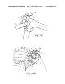 DEVICE AND METHOD FOR INSTALLING FEMORAL PROSTHETIC KNEE JOINT diagram and image