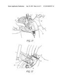 DEVICE AND METHOD FOR INSTALLING FEMORAL PROSTHETIC KNEE JOINT diagram and image