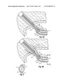 APPARATUS AND METHOD FOR SUTURING BODY LUMENS diagram and image