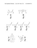 Apparatus and Method of Spinal Implant and Fusion diagram and image