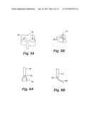 Apparatus and Method of Spinal Implant and Fusion diagram and image