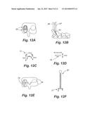 Apparatus and Method of Spinal Implant and Fusion diagram and image