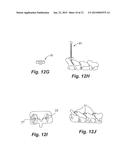 Apparatus and Method of Spinal Implant and Fusion diagram and image