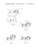 VERTEBRAL OSTEOSYNTHESIS EQUIPMENT diagram and image