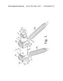 LONGITUDINAL CONNECTING MEMBER WITH SLEEVED TENSIONED CORDS diagram and image