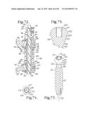 LONGITUDINAL CONNECTING MEMBER WITH SLEEVED TENSIONED CORDS diagram and image