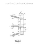 LONGITUDINAL CONNECTING MEMBER WITH SLEEVED TENSIONED CORDS diagram and image