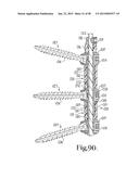 LONGITUDINAL CONNECTING MEMBER WITH SLEEVED TENSIONED CORDS diagram and image