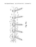 LONGITUDINAL CONNECTING MEMBER WITH SLEEVED TENSIONED CORDS diagram and image