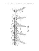 LONGITUDINAL CONNECTING MEMBER WITH SLEEVED TENSIONED CORDS diagram and image