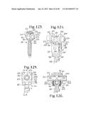 LONGITUDINAL CONNECTING MEMBER WITH SLEEVED TENSIONED CORDS diagram and image