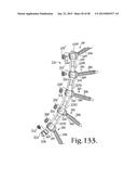 LONGITUDINAL CONNECTING MEMBER WITH SLEEVED TENSIONED CORDS diagram and image