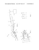 PERCUTANEOUS BLEPHAROPLASTY DEVICE AND METHOD diagram and image