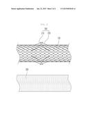 PROJECTION-TYPE PARTIALLY DUAL-STRUCTURED STENT diagram and image