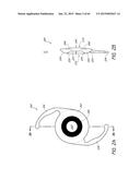 MASKED INTRAOCULAR IMPLANTS AND LENSES diagram and image