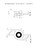 MASKED INTRAOCULAR IMPLANTS AND LENSES diagram and image