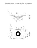 MASKED INTRAOCULAR IMPLANTS AND LENSES diagram and image