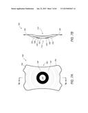 MASKED INTRAOCULAR IMPLANTS AND LENSES diagram and image